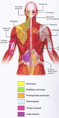 SINDROME DE DOLOR MIOFASCIAL